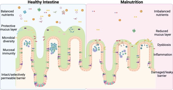 Worms intestinal virtue parasites infections